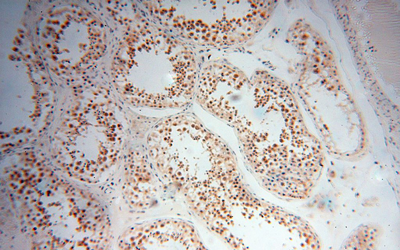 Immunohistochemical of paraffin-embedded human testis using Catalog No:112385(MAGEB18 antibody) at dilution of 1:100 (under 10x lens)