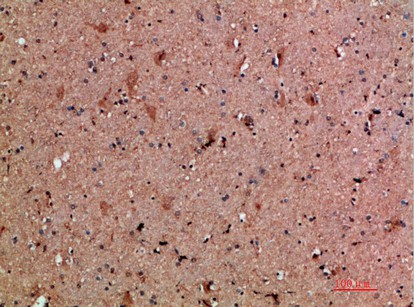 Fig1:; Immunohistochemical analysis of paraffin-embedded human-brain, antibody was diluted at 1:200