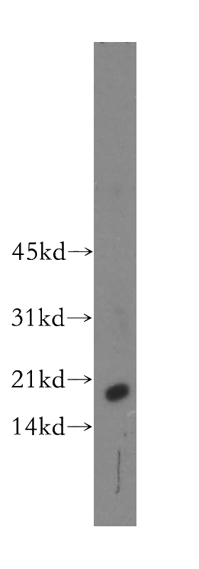 human kidney tissue were subjected to SDS PAGE followed by western blot with Catalog No:109615(CST9L antibody) at dilution of 1:500