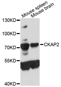 Western blot - CKAP2 Polyclonal Antibody 