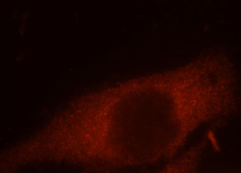 Immunofluorescent analysis of MCF-7 cells, using CCT8 antibody Catalog No:109037 at 1:25 dilution and Rhodamine-labeled goat anti-rabbit IgG (red).