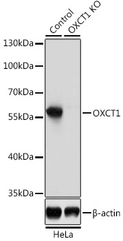 Western blot - OXCT1 Polyclonal Antibody 