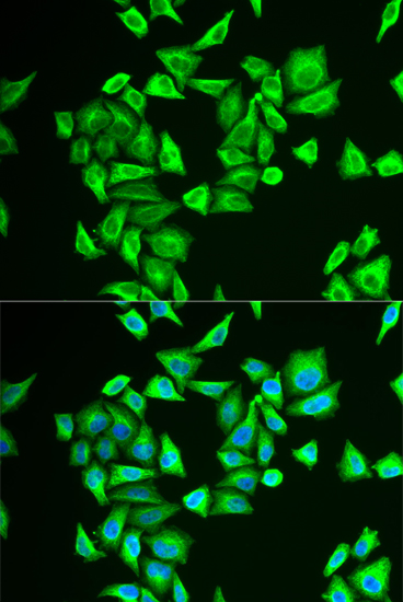 Immunofluorescence - PGM1 Polyclonal Antibody 