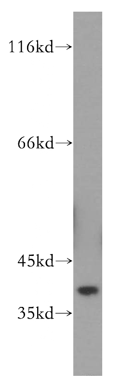 A431 cells were subjected to SDS PAGE followed by western blot with Catalog No:110115(DUSP11 antibody) at dilution of 1:400