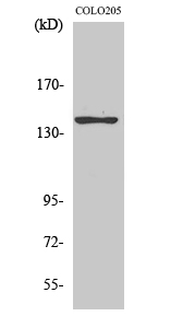 Fig1:; Western Blot analysis of COLO205 cells using A Cyclase V/VI Polyclonal Antibody.