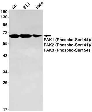 Western blot detection of PAK1 (Phospho-Ser144)/PAK2 (Phospho-Ser141)/PAK3 (Phospho-Ser154) in C6,3T3,Hela cell lysates using PAK1 (Phospho-Ser144)/PAK2 (Phospho-Ser141)/PAK3 (Phospho-Ser154) Rabbit pAb(1:1000 diluted).Predicted band size:61kDa.Observed band size:61kDa.