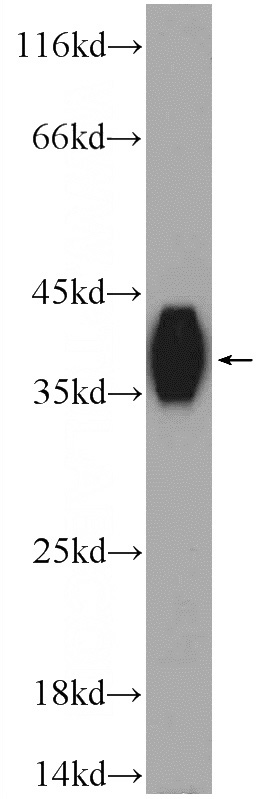 L02 cells were subjected to SDS PAGE followed by western blot with Catalog No:112036(KHDC1 Antibody) at dilution of 1:600
