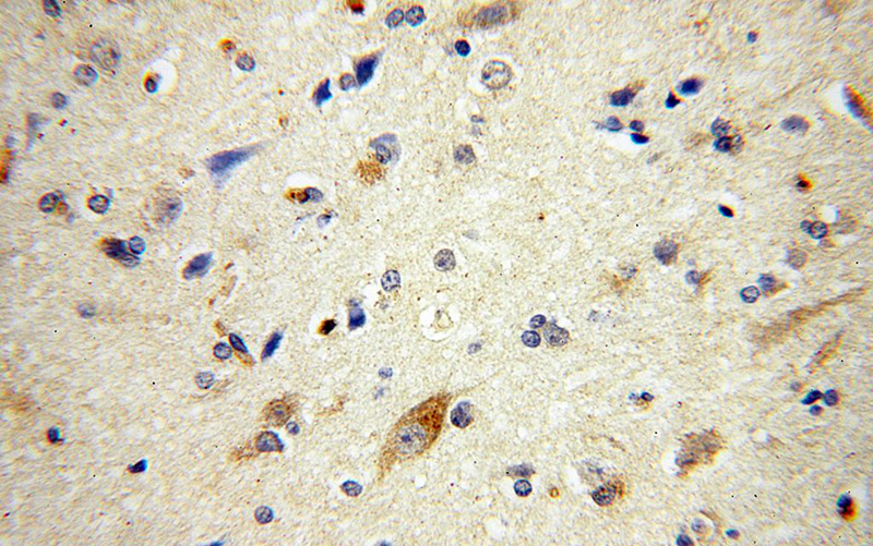 Immunohistochemical of paraffin-embedded human brain using Catalog No:108290(KIAA0652 antibody) at dilution of 1:100 (under 40x lens)