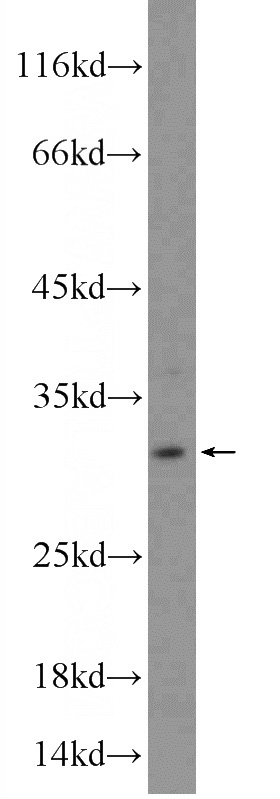 HeLa cells were subjected to SDS PAGE followed by western blot with Catalog No:116062(TIP30 Antibody) at dilution of 1:600