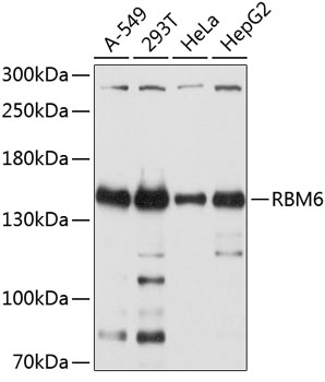 Western blot - RBM6 Polyclonal Antibody 
