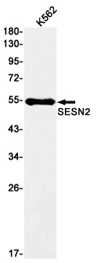Western blot detection of SESN2 in K562 cell lysates using SESN2 Rabbit mAb(1:1000 diluted).Predicted band size:55kDa.Observed band size:55kDa.