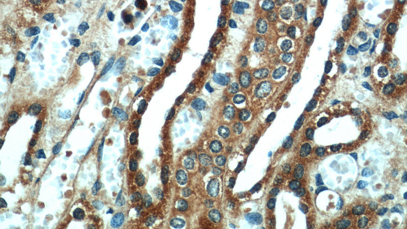 Immunohistochemical of paraffin-embedded human kidney using Catalog No:116731(VDAC2 antibody) at dilution of 1:50 (under 40x lens)