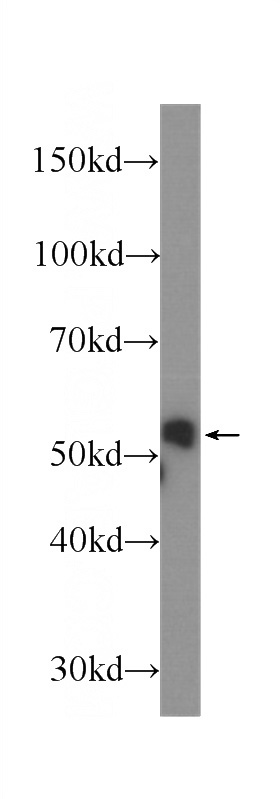 A549 cells were subjected to SDS PAGE followed by western blot with Catalog No:107234(KRT8 Antibody) at dilution of 1:1000