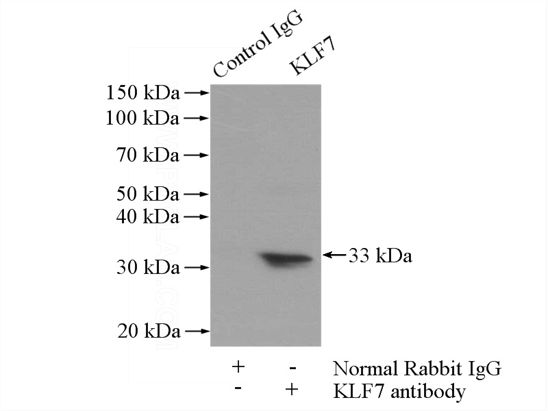 IP Result of anti-KLF7 (IP:Catalog No:112084, 4ug; Detection:Catalog No:112084 1:300) with K-562 cells lysate 3200ug.