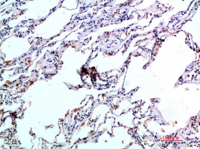 Fig1:; Immunohistochemical analysis of paraffin-embedded human-lung, antibody was diluted at 1:200
