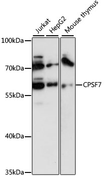 Western blot - FLJ12529 Polyclonal Antibody 