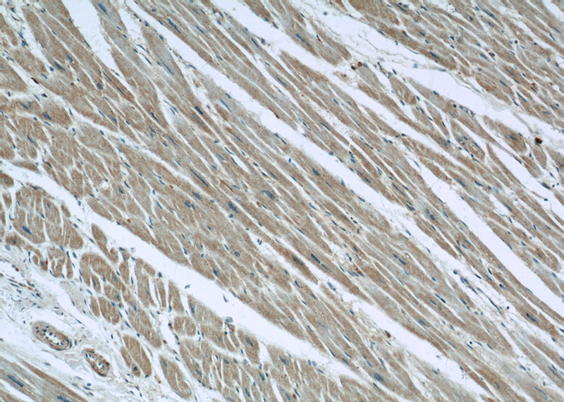 Immunohistochemical of paraffin-embedded human heart using Catalog No:113875(PIK3R6 antibody) at dilution of 1:50 (under 10x lens)