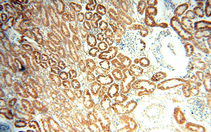 Immunohistochemical of paraffin-embedded human kidney using Catalog No:107851(AIF antibody) at dilution of 1:100 (under 10x lens)