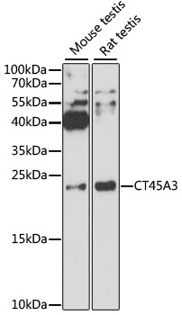 Western blot - CT45A3 Polyclonal Antibody 