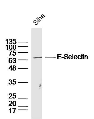 Fig4: Sample: Siha Cell Lysate at 40 ug; Primary: Anti- E-Selectin at 1/300 dilution; Secondary: IRDye800CW Goat Anti-Rabbit IgG at 1/20000 dilution; Predicted band size: 65 kD; Observed band size: 65 kD