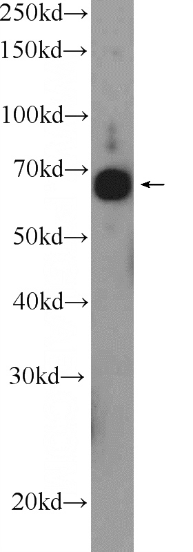 SKOV-3 cells were subjected to SDS PAGE followed by western blot with Catalog No:114553(RAPH1 Antibody) at dilution of 1:600