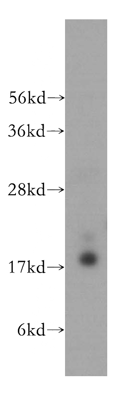 HeLa cells were subjected to SDS PAGE followed by western blot with Catalog No:114628(RFK antibody) at dilution of 1:500