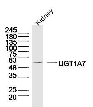 Fig1: Sample: Kidney (Mouse) Lysate at 40 ug; Primary: Anti-UGT1A7 at 1/300 dilution; Secondary: IRDye800CW Goat Anti-Rabbit IgG at 1/20000 dilution; Predicted band size: 57kD; Observed band size: 57kD