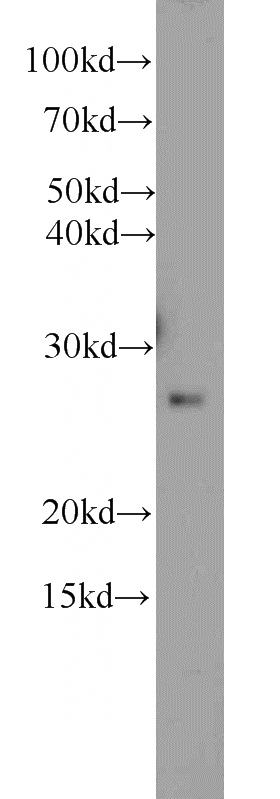mouse brain tissue were subjected to SDS PAGE followed by western blot with Catalog No:114432(RAB33A antibody) at dilution of 1:600