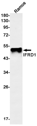 Western blot detection of IFRD1 in Ramos cell lysates using IFRD1 Rabbit mAb(1:1000 diluted).Predicted band size:50kDa.Observed band size:50kDa.