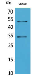 Western Blot analysis of Jurkat cells using MyoD Polyclonal Antibody. Secondary antibody was diluted at 1:20000