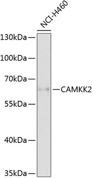 Western blot - CAMKK2 Polyclonal Antibody 