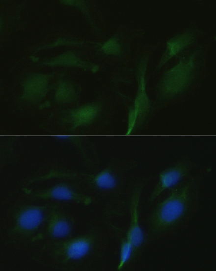 Immunofluorescence - TRPV1 Polyclonal Antibody 