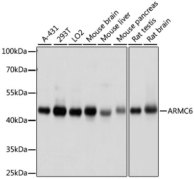 Western blot - ARMC6 Polyclonal Antibody 