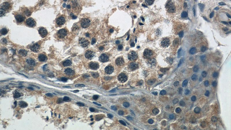 Immunohistochemistry of paraffin-embedded human testis tissue slide using Catalog No:108536(BTBD16 Antibody) at dilution of 1:50 (under 40x lens)