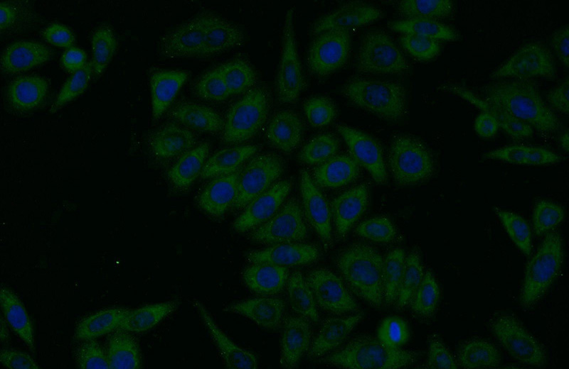 Immunofluorescent analysis of HeLa cells using Catalog No:115867(TBC1D24 Antibody) at dilution of 1:25 and Alexa Fluor 488-congugated AffiniPure Goat Anti-Rabbit IgG(H+L)
