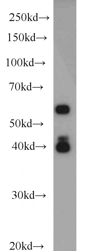 HeLa cells were subjected to SDS PAGE followed by western blot with Catalog No:113494(PAIP1 antibody) at dilution of 1:1000