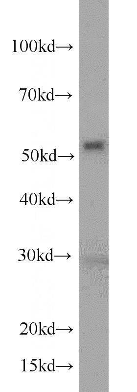 HeLa cells were subjected to SDS PAGE followed by western blot with Catalog No:107217(FKBP52 antibody) at dilution of 1:500