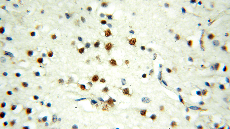Immunohistochemical of paraffin-embedded human brain using Catalog No:112636(MEF2C antibody) at dilution of 1:50 (under 40x lens)