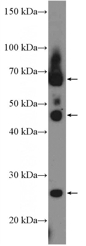 MDA-MB-453s cells were subjected to SDS PAGE followed by western blot with Catalog No:108025(APOBEC3B Antibody) at dilution of 1:300