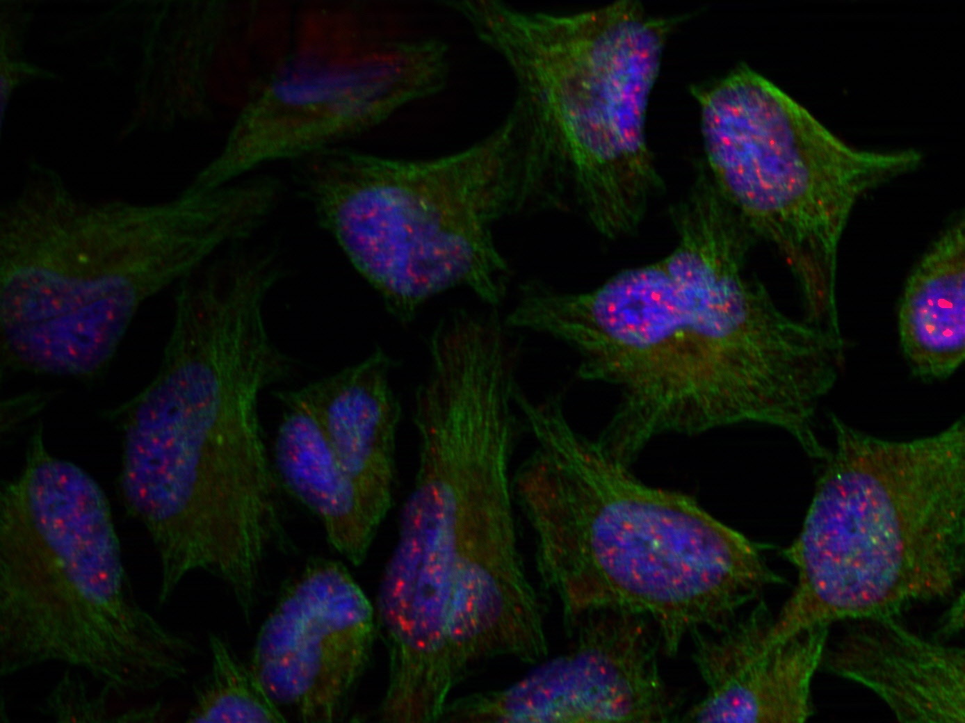 Immunofluorescence staining of methanol-fixed Hela cells using AKT1 (phospho-Thr450) Antibody .