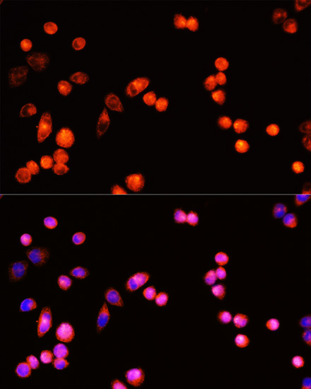 Immunofluorescence - TGFBR3 Polyclonal Antibody 
