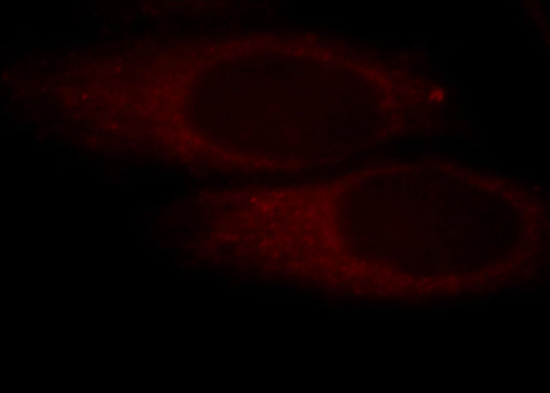 Immunofluorescent analysis of HepG2 cells, using POTEA antibody Catalog No:114067 at 1:25 dilution and Rhodamine-labeled goat anti-rabbit IgG (red).