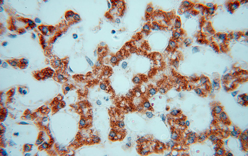 Immunohistochemical of paraffin-embedded human liver using Catalog No:111192(GSTT1 antibody) at dilution of 1:50 (under 40x lens)