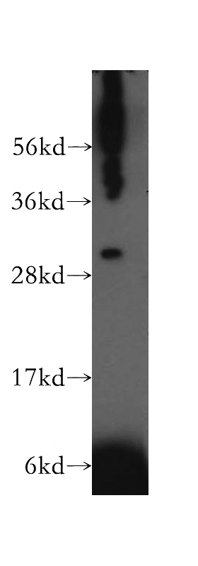 K-562 cells were subjected to SDS PAGE followed by western blot with Catalog No:116351(TRAV20 antibody) at dilution of 1:500