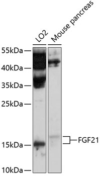 Western blot - FGF21 Polyclonal Antibody 