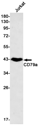 Western blot detection of CD79a in Jurkat cell lysates using CD79a Rabbit mAb(1:500 diluted).Predicted band size:25kDa.Observed band size:45-55kDa.