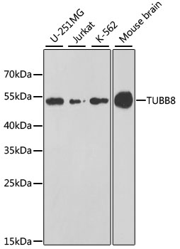 Western blot - TUBB8 Polyclonal Antibody 