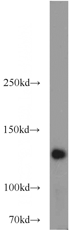 HeLa cells were subjected to SDS PAGE followed by western blot with Catalog No:113374(NUP133 antibody) at dilution of 1:1000
