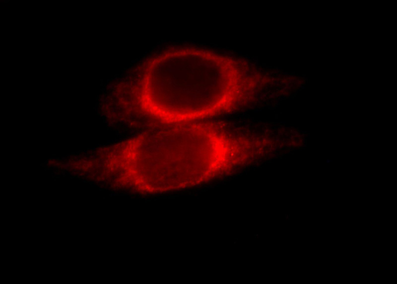 Immunofluorescent analysis of Hela cells, using ORM2 antibody Catalog No:113426 at 1:25 dilution and Rhodamine-labeled goat anti-rabbit IgG (red).