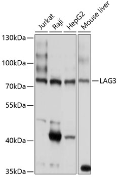 Western blot - LAG3 Polyclonal Antibody 
